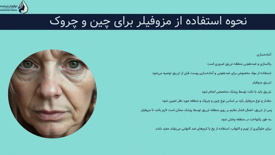 نحوه استفاده از مزوفیلر برای چین و چروک